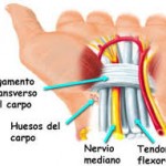 Neurodinamica en el tratamiento del síndrome del túnel carpiano