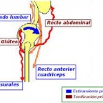 Rotura de Músculos Isquiosurales