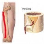 ¿Qué es una periostitis tibial?