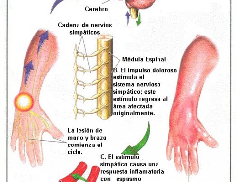 Hinchazón de tripa causas