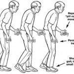 Enfermedad de Parkinson